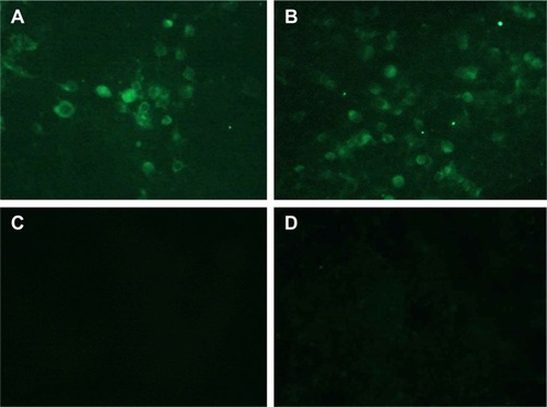 Figure 7 In vitro expression of the pFDNA-LDH@SiO2-NPs in 293 T cells assayed by indirect immunofluorescence (×40).Notes: (A) Naked plasmid pVAX1-F(o) DNA group. (B) Transfected pFDNA-LDH@SiO2-NPs group. (C) Blank LDH@SiO2-NPs group. (D) 293 T cell group as the negative control.Abbreviations: LDH, layered double hydroxide; NPs, nanoparticles; pFDNA-LDH@SiO2-NPs, Newcastle disease virus F gene encapsulated in LDH@SiO2-NPs.