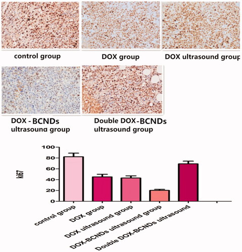 Figure 9. Immunohistochemical (IHC) detection of Ki67 in paraffin sections of tumors.