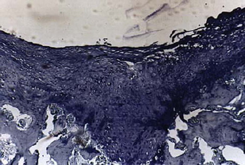 Figures 6. Sagittal sections of cartilage defects transplanted with MSCs derived from muscle (5) at 12 weeks (toluidine blue staining × 400).