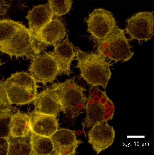 Figure 4 Incubation of 6 hours between RAW 264.7 and microbubbles. Cells are stained with fluorescein isothiocyanate phalloidin (green) while microbubbles are tetramethylrhodamine isothiocyanate (red) labeled. Cellular uptake is observed.