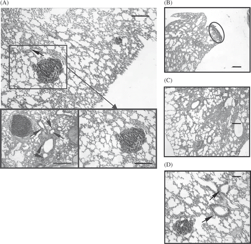 Figure 4. Histological sections of the lungs of mice treated without (A) chemotherapy, (original magnification × 100 and bar 200 µm, local magnification × 200 and bar 100 µm), (B) whole body hyperthermia (magnification × 100, bar 100 µm), (C) combined therapy of hyperthermia and chemotherapy and (D) not treated (magnification × 100, bar 100 µm). Arrowheads: vessel sprout. Circle: metastasis nodules.