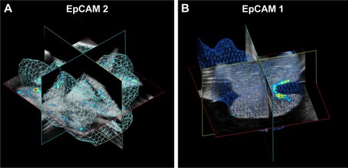 Figure 9 Volumes of calculation of averaged PA signal in (A) EpCAM 2 and (B) EpCAM 1 liver samples.Abbreviations: EpCAM, epithelial cell adhesion molecule; PA, photoacoustic.