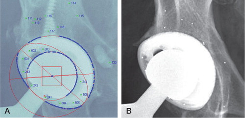 Figure 2. A. Image of a total hip replacement with RSA markings. The acetabular shell and femoral head are defined by edge detection (ellipses), the marked tantalum beads in the pelvic bone are numbered 111–118, and the polyethylene liner beads are numbered 231–236 and 241–243. B. AP hip image showing the unmarked tantalum beads in the pelvis and liner.