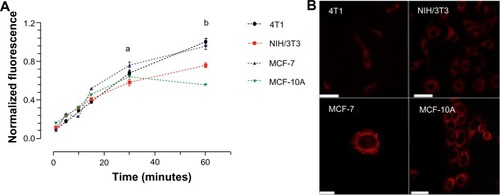 Figure 7 In vitro incorporation of AlPc-NPs by cancerous (4T1 [murine] and MCF-7 [human]) and noncancerous (NIH/3T3 [murine] and MCF-10A [human]) cells.Notes: (A) Evolution of incorporation with time; aP<0.01 for 4T1 versus NIH/3T3, P<0.001 for MCF-7 versus MCF-10A; bP<0.001 for 4T1 versus NIH/3T3 and for MCF-7 versus MCF-10A. (B) Confocal images of cells exposed to AlPc associated to PVM/MA NPs (AlPc-NPs; concentration equivalent to 0.25 μM AlPc) for 15 minutes; AlPc appears in red; the scale bar (white rod) length is equal to 50 μm for 4T1, NIH/3T3, and MCF-10, and 10 μm for MCF-7.Abbreviations: AlPc, aluminum–phthalocyanine chloride; NPs, nanoparticles; PVM/MA, poly(methyl vinyl ether-co-maleic anhydride).