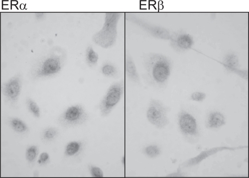 Figure 1 The expression of ERα and ERβ in human epidermal keratinocytes cultured from human female breast skin. Both nuclear and cytoplasmic expression of ERα and ERβ, with intense staining in the perinuclear region was seen in epidermal keratinocytes derived from female breast skin.