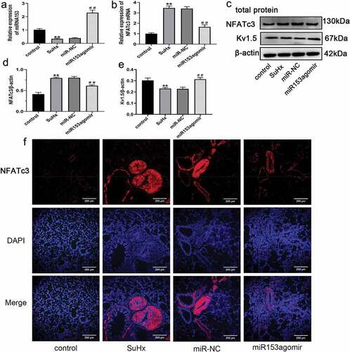 Figure 4. Effect of miRNA153 on NFATc3 in SuHx-induced PH. (a, b) RT-qPCR analysis of mRNA153 and NFATc3 mRNA expression in the pulmonary artery tissues of rats after treatment of miR153agomir. (c, d, e) The protein levels of NFATc3 and Kv1.5 in pulmonary artery tissue of rats were detected by western blot assay. (F)The expression of NFATc3 in pulmonary artery tissue was assessed by immunofluorescence staining (100× magnification). N = 10 per group *P < .05, **P < .01 vs control group; #P < .05, ##P < .01 vs miR-NC group. All data are mean ± SEM. miRNA153, microRNA153; NFATc3, nuclear factor of activated T cell isoform c3; SuHx, SU5416 combined with hypoxia; PH, pulmonary hypertension; RT-qPCR, quantitative real-time polymerase chain reaction; Kv1.5, potassium voltage-gated channel subfamily A member 5; SEM, standard error of mean.