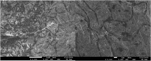 Figure 6. (a), (b). Scanning electron microscopic image showing biofilm of L. rhamnosus.