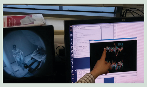 Figure 3. Magnetoencephalography scanning of child aged 8 years and corresponding signal output.Magnetoencephalography scanning of boy aged 8 years shows user-friendly, non-invasive system with corresponding brain activity measurement on screen.