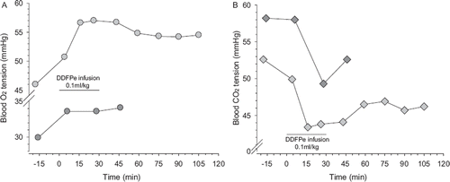 Figure 6. Panel A: arterial oxygen tension (PaO2), light grey circles and, venous oxygen tensions (PvO2), dark grey circles versus time in air-breathing pig with nosocomial pneumonia before, during and after infusion of 0.1 ml/kg (body weight) of DDFPe. Panel B: arterial carbon dioxide (PaCO2), light grey diamonds, and venous carbon dioxide (PvCO2) tensions, dark grey diamonds, in the same pig.