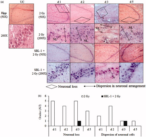 Figure 5. Effect of Hippophae leaf extract (SBL-1) on radiation-induced histological changes in hippocampus (Hipp) of rat brain. (a) Microscopic observations of haematoxylin- and eosin-stained tissue sections are presented at 50 × and 200 × magnifications. (b) Changes with respect to untreated control (UC, group I) are graded on number scale with 0 as minimum and 6 as maximum using arbitrary units (AU).