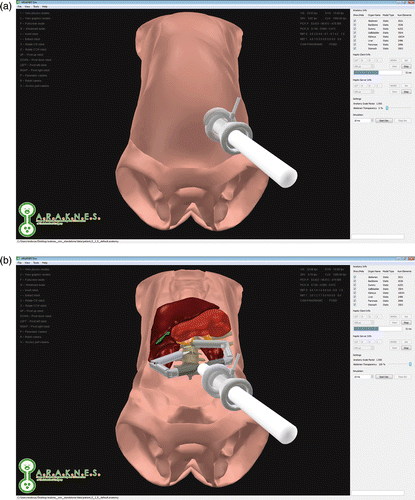 Figure 2. Screenshots during a surgical simulation, showing the virtual environment with a patient-specific anatomy and the bimanual robot, and a side panel for the settings. (a) Port placement with the abdomen rendered opaque. (b) Workspace evaluation with the abdomen rendered transparent.