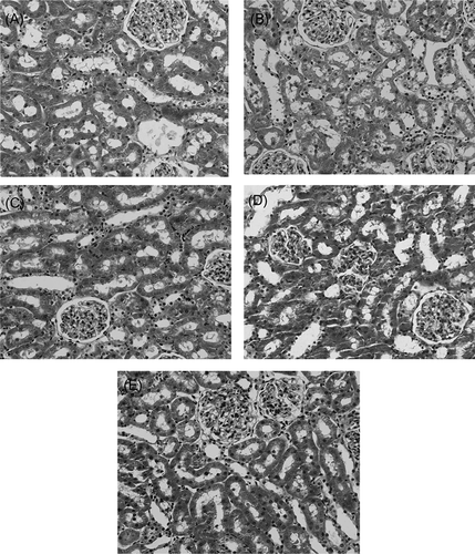 Figure 3. Histopathological changes in renal tissue in different groups: (A) sham group; (B) IR group; (C) IR + PTX group; (D) IR + NAC group; and (E) IR + PTX + NAC group. Hematoxylin and eosin, magnification 400×.