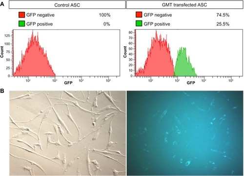 Figure 3 Analysis of transfection efficiency of ASCs with pmGENIE-3-GMT.