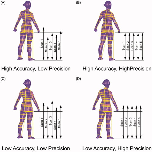 Figure 1. Accuracy and precision’s relationship in body scanning measurements.