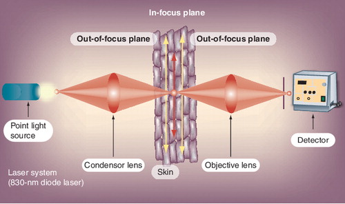 Figure 1. Simplified optical principle of reflectance confocal microscopy illustrating the way of the light from the point light source to the skin and onto the detector.Information from Citation[27].