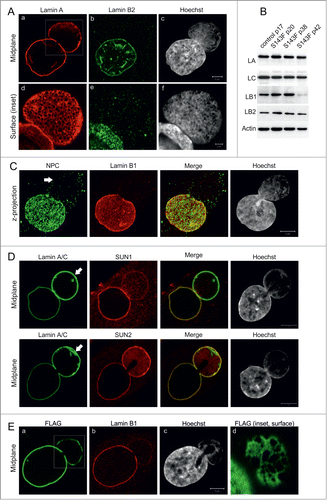 Figure 1. p.S143F mutation in LA induces stable blebs. (A) Primary fibroblasts (p15) from a patient carrying the 428 C > T (p.S143F) mutation in the LMNA gene showed nuclear blebs with enlarged LA/C meshwork and little or no LB2. The cells were stained with antibodies for LA/C and LB2. Hoechst was used to visualize DNA. Single confocal sections from mid-plane (first row) and bleb surface (boxed area, second row) are shown. Note the fine chromatin strands that co-align with the LA/C meshwork in nuclear blebs while DNA staining is generally reduced compared to the main nuclear body. Scale bar 5 μm. (B) The presence of blebs is not due to changes in lamin expression. P.S143F patient fibroblasts at different passages and fibroblasts from a healthy control were harvested and the expression levels of LA/C, LB1 and LB2 were analyzed by western blotting. Actin was used as a loading control. The expression of LB1 was significantly reduced at p42 when the cells stopped proliferating. (C) Blebs are devoid of NPCs. Primary p.S143F fibroblasts (p28) were stained for NPCs and LB1. Hoechst was used to visualize DNA. Z-axis projections of the images in different regions of the whole nucleus are shown. An arrow indicates the bleb. (D) SUN1 and SUN2 localization in blebs. P.S143F fibroblasts were stained for either SUN1 or SUN2, LA/C and Hoechst. Note that SUN1 is markedly reduced while SUN2 is enriched at the NE of blebs. Arrows show blebs. Scale bars 5 μm. (E) The expression of FLAG-tagged p.S143F-LA induces the formation of blebs in cultured HeLa cells. HeLa cells were transiently transfected with a vector encoding FLAG-tagged p.S143F-LA. 72 hours (hrs) after transfection, the cells were stained with anti-FLAG, anti-LB1 and Hoechst. Single mid-plane confocal sections from the whole cell (A-C) and from the surface of the bleb (boxed area, D) are shown. Scale bars 5 μm.