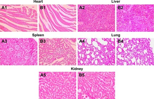 Figure 6 Histopathological studies of heart, liver, spleen, lung, and kidney.