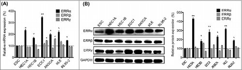 Figure 1. The expression of ERRα/β/γ in EC cells. (A) The mRNA expression of ERRα/β/γ in human EC and ESC cells were checked by qRT-PCR; (B) The protein expression of ERRα/β/γ in human EC and ESC cells were checked by western blotting (left) and quantitatively analyzed (right). Each experiment has been replicated for three times. *p < 0.05, **p < 0.01 as compared with the control group.