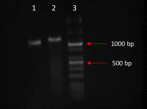 Figure 3. Analysis of the homologous recombination CD55 transgene into allele of the ULBP1 porcine gene for #308 individual. Polymerase chain reaction (PCR) was used to amplify DNA fragments of 985 bp (lane 1) and 1076 bp (lane 2). PCR products are only amplified in case of HDR-mediated transgene integration. The KAPA Universal Ladder Kits was used as size marker (lane 3). Separation of DNA fragments was conducted in 1.5% agarose gel.