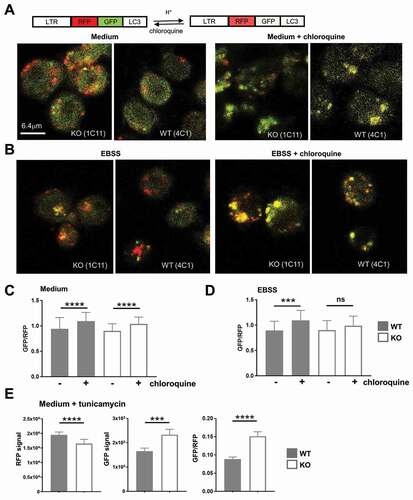 Figure 8. TFG supports autophagosome turnover in CH12 B cells. (a) CH12 tfg WT (4 C1) and KO B cells (1E10) were infected with a retrovirus encoding the RFP-GFP-LC3-fusion protein. LTR: long terminal repeat; RFP, red fluorescence protein. Cells kept for 2 h in medium with or without 100 µM chloroquine were attached to glass slides, fixed and analyzed by confocal microscopy (single plane). (b) CH12 tfg WT (4 C1) and KO B cells (1E10) were infected with a retrovirus encoding the RFP-GFP-LC3 fusion protein. Cells were attached to glass slides in EBSS for 2 h with or without 100 µM chloroquine, fixed and analyzed by confocal microscopy (single plane). (c), (d) GFP:RFP ratios of single autophagosomes (please see Figure S8) were calculated and are depicted as mean and SD; student’s t-test, *** p < 0.001, **** p < 0.0001, (e) CH12 tfg WT (clones 3A4, 4C1, 4C4) and KO B cells (clones 1C11, 1E10) were infected with a retrovirus encoding the RFP-GFP-LC3 fusion protein. Cells were attached to glass slides in medium for 2 h with or without 5 μM tuncamycin and fixed. GFP and RFP fluorescence intensities of single autophagosomes (392–798 per condition) were determined by confocal microscopy (single plane). Data are not represented by scatter plots due to too many data points and are shown as median +95% CI student’s t-test: *** p < 0.001, **** p < 0.0001