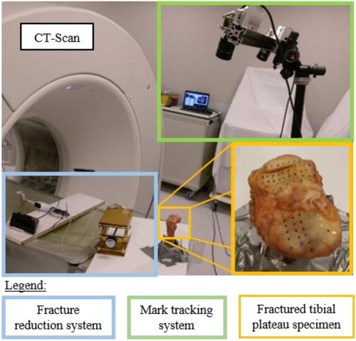 Figure 1. Experimental devices to perform surgery under periodic (every 0.5 cm3 of water injected in the expending balloon) CT-Scan acquisitions and mark-up tracking. (The table translation is controlled).