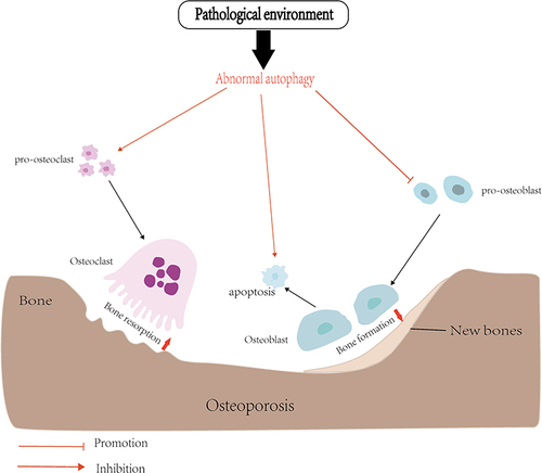 Figure 2 In the pathological environment, abnormal autophagy of OCs and OBs, increased bone resorption and insufficient bone formation lead to osteoporosis.