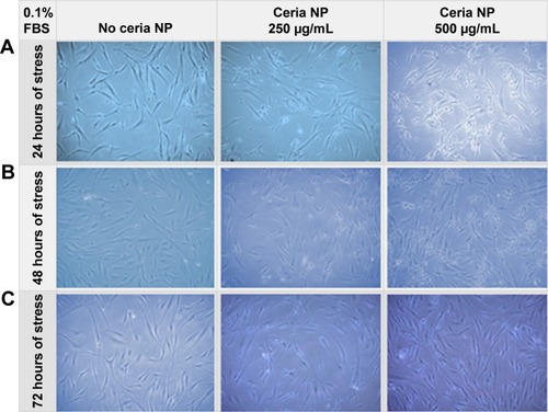 Figure 5 NP-pretreated HDF cells were stressed by reducing the FBS concentration to 0.1%.Notes: Phase contrast images were collected, after 24 hours (A), 48 hours (B), and 72 hours (C). First column shows images with no pretreatment, while second and third columns show images of wells pretreated with 250 µg/mL and 500 µg/mL of ceria NP, respectively. Magnification: 100×. Cells were recovered in fresh medium for 24 hours.Abbreviations: FBS, fetal bovine serum; HDF, human dermal fibroblasts; NP, nanoparticle.