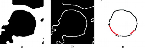 Figure 8. Smoothed image after cropping and threshold (a), after edge detection (b) and after artery side reconstruction (c).