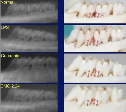 Figure 11 Representative periapical radiographs and morphometric images of each group.