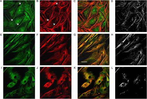Figure 4. The cytoskeleton-S-glutathionylation concerns actin MF and MT. Immunofluorescence analysis of the cytoskeleton glutathionylation. GS-Pro (A) and phalloidin (B) double staining showed a codistribution (C) in correspondence to stress fibers (arrows in A and B), with a significant colocalization pattern as visualized by their colocalization mask (D). Double immunolabeling of protein-S-glutathionylation (E) in association with tubulin (F), exhibited a complete overlap degree between GS-Pro and MT (yellow signal in G) in all distribution points (colocalization mask in H). Protein-S-glutathionylation (I) and intermediate vimentin filaments (J) showed a partial codistribution particularly in central and perinuclear areas (K), as pointed out by their colocalization mask (L). Scale bar, 40 µm.