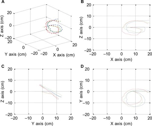 Figure 23 Multiple views of the predicted reverse gamma loop test are shown. Isometric view (A), right-side view (B), left-side view (C), top view with right side as X axis (D).