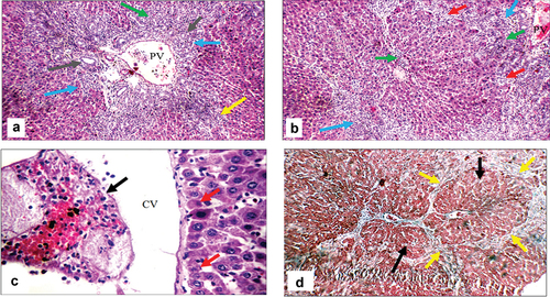 Figure 7. Histopathologic features of liver sections from bile duct-ligated group. (a) Section stained with hematoxylin and eosin (H&E) shows markedly expanded edematous portal tract (blue arrows) with a markedly dilated, congested portal vein (PV), proliferating bile ducts (grey arrows), moderate portal (green arrow), and peri-portal inflammatory infiltrate (yellow arrow) (X200). (b) Another view from the same group shows markedly expanded edematous portal tracts (blue arrows) with markedly dilated PV, irregular hepatic lobule (red arrows), and moderate peri-portal inflammatory infiltrate (green arrows) (H&E, X200). (c) Another view from the same group shows markedly dilated central vein with intra-venous embolus (black arrow) and scattered apoptotic hepatocytes in the peri-venular area (red arrows) (H&E, X 400) (d) Masson trichrome stained section from the same group shows excess collagen (yellow arrows) with nodular formation (black arrows) (X200).