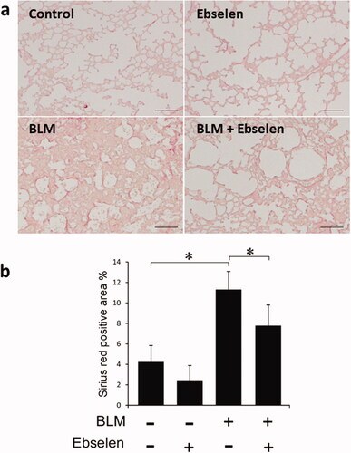 Figure 3. Effect of ebselen on BLM-induced pulmonary fibrosis. (a) Ebselen was given orally 5 days per week after the administration of BLM. Two weeks later, lungs were collected for analysis. There was no staining, other than perivascular, observed in the control and ebselen groups. Collagen accumulation was observed in the BLM + vehicle group; in contrast, collagen was suppressed in the BLM + ebselen group. (b) Observation of collagen fibers through Sirius Red staining and calculation of the area ratio of accumulated collagen were performed. BLM: bleomycin; PBS: phosphate buffered saline. P < 0.05 denotes a statistically significant difference.