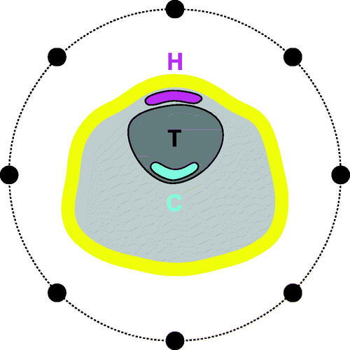 Figure 5. Illustrating the hot-spot (H, magenta) and cold-spot (C, cyan) sub-volumes. Schematic of neck section with target volume T and a ring applicator (black dots). Both H and C are equal to a fraction p of the target volume. The first centimeter of skin (yellow) is excluded from the spot evaluation. Note that the hot- and cold-spot sub-volumes are not necessarily contiguous sub-sets of the target T and the remaining tissue R, respectively.