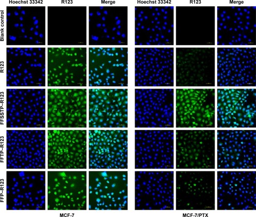 Figure 6 CLSM study of MCF-7 and MCF-7/PTX cells incubated with free R123, FFSSTP/R123, FFTP/R123, or FFP/R123 micelles for 4 h, respectively.Notes: Green: R123; blue: cell nucleus stained by Hoechst 33342; scale bars =50 μm.Abbreviations: CLSM, confocal laser scanning microscope; FA, folate; FFP, F127-FA/FT/P123; FFSSTP, F127-folate/F127-disulfide bond-d-α-tocopheryl polyethylene glycol 1000 succinate/P123; FFTP, F127-FA/FT/P123; FT, F127-TPGS; PTX, paclitaxel; R123, rhodamine 123; TPGS, d-α-tocopheryl polyethylene glycol 1000 succinate.