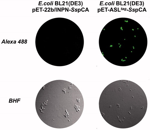 Figure 1. Fluorescence microscopy of E. coli BL21(DE3) cells transformed with pET-22b/INPN-SspCA (left) or with pET-ASLtag-SspCA (right). The cells were incubated with BG-FL and then analysed by fluorescence microscopy. Images show bright field (BHF) and AlexaFluor488 (green). As expected, the fluorescence is only evidenced for the bacterial cell transformed with the ASLtag system.