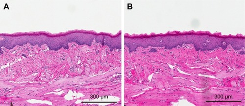Figure 8 Optical microscopy images of hematoxylin and eosin stained sections of sublingual mucosa for administration of (A) normal saline and (B) IPC-DNVs.Abbreviations: DNVs, deformable nanovesicles; IPC, insulin-phospholipid complex.