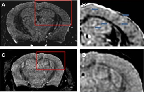 Figure 4 Amyloid plaques detected with in vivo mMRI after intravenous femoral injection of USPIO-PEG-Aβ1-42.Notes: (A) In vivo T2*-weighted mMRI images of a 14-month-old APP/PS1 transgenic mouse. (B) A higher magnification of the area in the red box shown in (A). Arrowheads highlight some amyloid plaques detected by mMRI. (C) In vivo mMRI of a 16-month-old wild-type mouse after intravenous femoral injection of USPIO-PEG-Aβ1-42. (D) A higher magnification of the area in the red box shown in (C). Adapted with permission from Wadghiri YZ, Li J, Wang J, et al. Detection of amyloid plaques targeted by bifunctional USPIO in Alzheimer’s disease transgenic mice using magnetic resonance microimaging. PLoS One. 2013;8(2):e57097.Citation120Abbreviations: mMRI, magnetic resonance microimaging; USPIO, ultrasmall superparamagnetic iron oxide; PEG, polyethylene glycol.