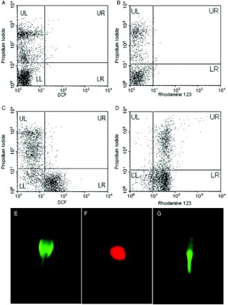 Figure 1.  Dihydrorhodamine 123 (DHR123) and dichlorofluoresceindiacetate (DCFH-DA) staining in human spermatozoa. Flow cytometric dot plot of semen sample stained with DCFH-DA/ propidium iodide (PI) (A and C) and DHR123/ PI (B and D). Panels A and B represent PI control without DCFH-DA and DHR123 whereas panels C and D represent reactive oxygen species (ROS) production in the live or dead sperm population that were stained with DCFH-DA and DHR123, respectively. Fluorescence microscopy image of human spermatozoa shows DCFH-DA staining for cytosolic ROS detection (E), PI was used as a counter stain to assess membrane integrity (F), and DHR123 staining for mitochondrial ROS in mid-peace (G). Scale bar is equal to 100 µm.