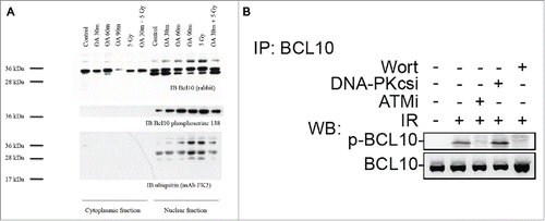 Figure 6. ATM phosphorylates BCL10 is in response to DNA damage. (A) Cells were treated with the indicated drugs and cytoplasmic and nuclear fractions were isolated. BCL10 immunoprecipitation was conducted using BCL10 antibodies. Immunoblots were performed as indicated. (B) Cells were incubated with the indicated inhibitors (20μM Wort., Wortmannin; 2μM DNA-PKi, DNA-PK inhibitor; 10 μM ATMi, ATM inhibitor) for 1 hr and then exposed to IR (10 Gy). Nuclear extracts were isolated and subjected to immunoprecipitated using BCL10 antibody. Western blot analysis was conducted with BCL10 and p-BCL10 antibodies.