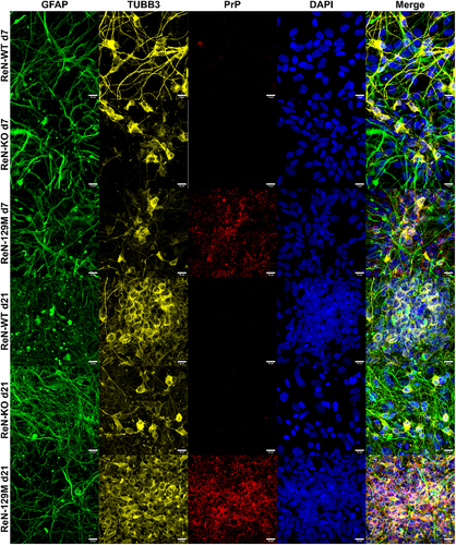 Figure 4. PrPC is localized to TUBB3 expressing neurons in ReN 129M cells. Immunofluorescence was used to image ReN WT, KO and 129M cells by staining for TUBB3 (yellow), GFAP (green) and PrP (Red). Nuclei were counterstained with DAPI (Blue). Representative images are shown at days 7 and 21 post-differentiation. Images were acquired using the 63X oil immersion objective of a Zeiss LSM 700 instrument (scale bar = 10 µm).