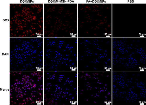 Figure 4 Confocal laser scanning microscopy images of SW1990 cells following incubation with DG@NPs, DG@M-MSN-PDA, FA+DG@NPs and PBS. Red and blue represent DOX and DAPI fluorescence, respectively (scale bar: 20 µm).