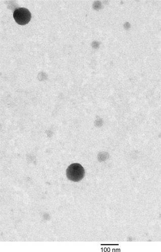 Figure 2 Transmission electron microscopy of SN38-loaded targeted liposomes.Note: Magnification (×100 k) at 75 kv.