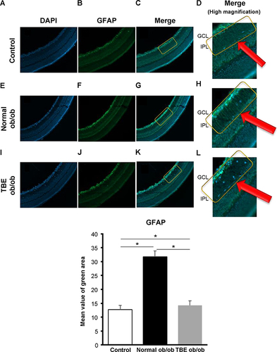 Figure 4 The effect of TBE on glial activation. A comparison of GFAP immunofluorescence (green) when the control mice (A–D) and ob/ob mice were fed with a normal diet (E–H) or diet containing TBE (I–L). In the diabetic retina of mice fed with a normal diet, compared with the control mice, we observed that strong staining of radial projections of Muller cells along the IPL was attenuated ((F–H) (within the yellow line, red arrows: magnified image within the yellow line)). In the diabetic retina of TBE ob/ob mice, compared with the normal ob/ob mice, GFAP expression was significantly decreased, and there were fewer Muller cell protrusions ((J–L) (within the yellow line, red arrows: magnified image within the yellow line)). Values are expressed as means ± SD. *P < 0.05. Nuclei were counter-stained with DAPI (blue).