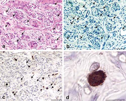 Figure 1. Human CBs contain cells that express PrPC. CBs are identified with haematoxylin and eosin (Panel a) and toluidine blue (Panel b) and consist of clusters of cells separated by bands of connective tissue. Note the large number of blood vessels that supply the clusters of cells; lumens of some blood vessels are indicated by arrows. Cells in the CBs that express PrPC are not Type I or Type II cells, but instead are relatively large oval or oblong cells scattered throughout the CB and located primarily in the connective tissue that surrounds the CB lobules (Panel c); lumen of some blood vessels are indicated by arrows. A single PrPC-expressing cell (inside the box in Panel c) is enlarged in Panel d and is seen to have the morphology and dense granular appearance that is characteristic of mast cells; lumens of some blood vessels are indicated by arrows. Scale bars: Panel a,b, c = 100 µm; Panel d = 10 µm.