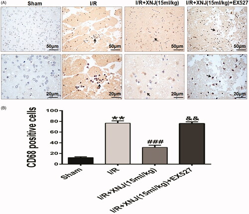 Figure 6. EX527 dramatically blocked the effects of XNJ on the repression of macrophage activation. (A) Representative immunohistochemical staining images of macrophage cells; (B) Quantification of macrophage/microglia cells. (**p < 0.01 vs. sham; ###p < 0.001 vs. I/R; &&p < 0.01 vs. I/R + XNJ). n = 4 in each group.