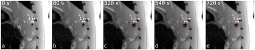 Figure 2. Formation of gas bubbles and tissue carbonization during MWA lead to an development of the signal void around the center of the ablation zone in imaging of MR-thermometry. The red lines indicate the contours of the signal void found by the semi-automatic segmentation approach. In addition, the time after starting of the ablation procedure (duration 720 s) is given.