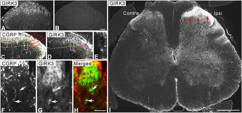 Figure 5 Expression and regulation of GIRK3 in spinal cord. GIRK3-LI is present in control dorsal horn (A), and is absent after pre-incubation of the antibody with 10−6 M immunogen in the absorption test (B). (C, D) GIRK3-LI (D) is largely localized in the superficial laminae but much weaker than CGRP-LI (C), and also present in a few interneurons in deeper laminae (E, G, H). Representative micrographs show GIRK3+ (G and H; arrows) but CGRP− (F; arrows) interneurons in deeper laminae (GIRK3, green; CGRP, red). (I) Fourteen days after axotomy, a dramatic upregulation of GIRK3-LI (red arrows) is seen on the ipsilateral (ipsi) as compared to contralateral (contra) spinal dorsal horn. Scale bars indicate 500 μm (I), 100 μm (A–D), 50 μm (F–H) and 25 μm (E).