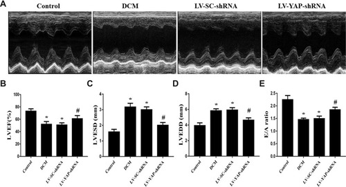 Figure 4(A) Cardiac function data in four groups of rats. M-mode echocardiograms in the 4 groups (n=5). (B) Indicated left ventricular ejection fraction (LVEF) in the 4 groups. (C) Left ventricular end systolic dimension (LVESD) in the 4 groups. (D) Left ventricular end diastolic diameter (LVEDD) in the 4 groups. (E) Ratio of peak early to late diastolic filling velocity (E/A ratio) respective levels in the 4 groups. *P<0.05 versus the control group; #P<0.05 versus the LV-SC-shRNA group.