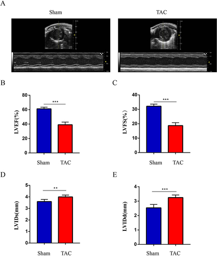 Figure 6 Established TAC-induced mouse model of HF. (A) Images of heart ultrasound; (B). LVEF: left ventricular ejection fraction; (C). LVFS: left ventricular fractional shortening; (D). LVIDs: left ventricular internal diameter at end-systole; (E). LVIDd: left ventricular internal diameter at end-diastole. Values are expressed as mean (± SD) (n=5); **p < 0.01 and ***P < 0.001 vs Sham group.